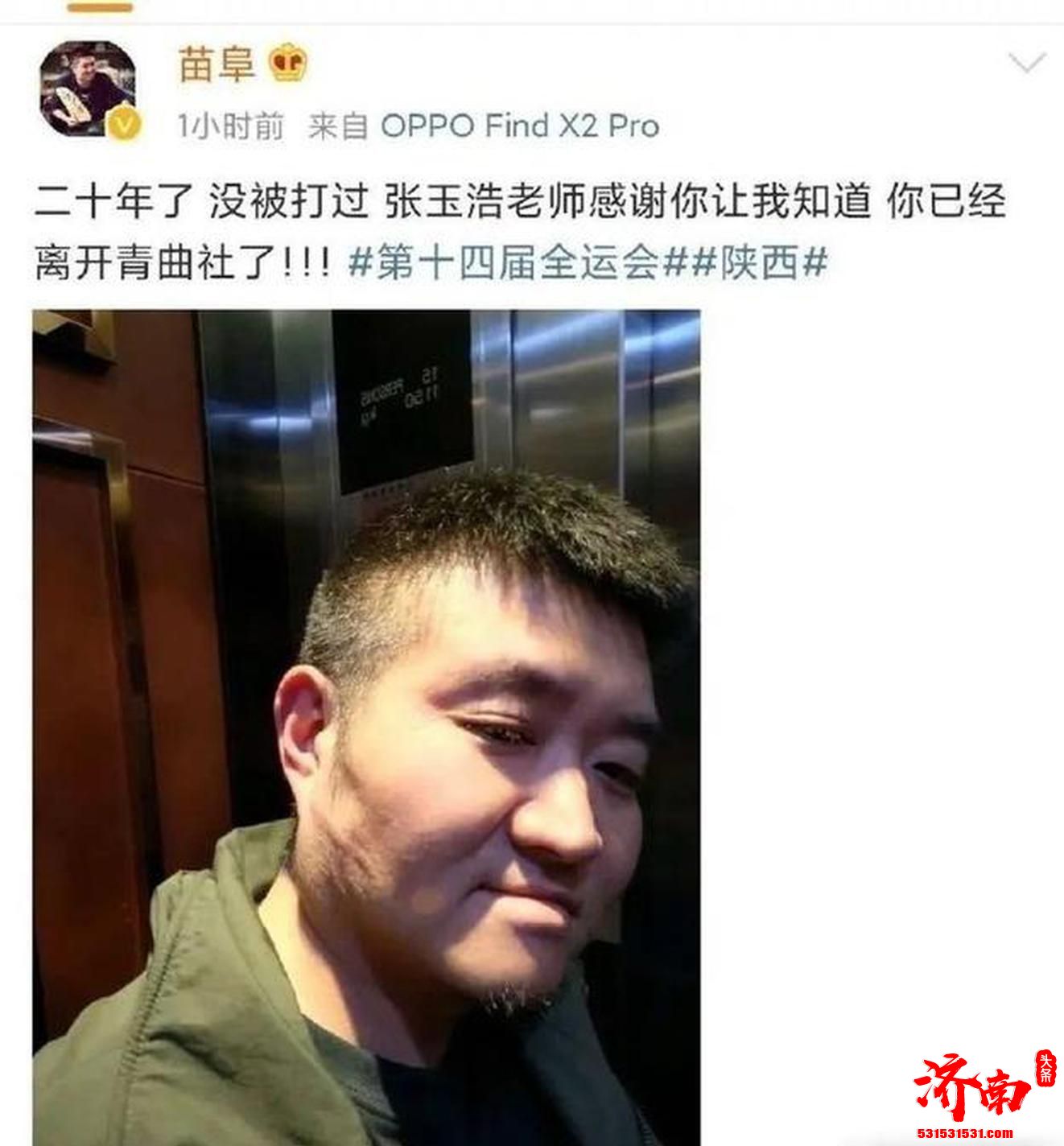 苗阜晒脸部抓伤照自曝被张玉浩打 后又删除微博