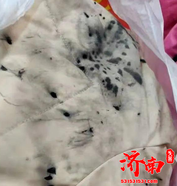 最近多名女性在网上爆料 自己穿的浅色衣服在西安街头 被一名男子喷洒墨水